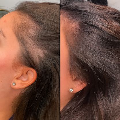 Castor Oil Hair Growth Serum