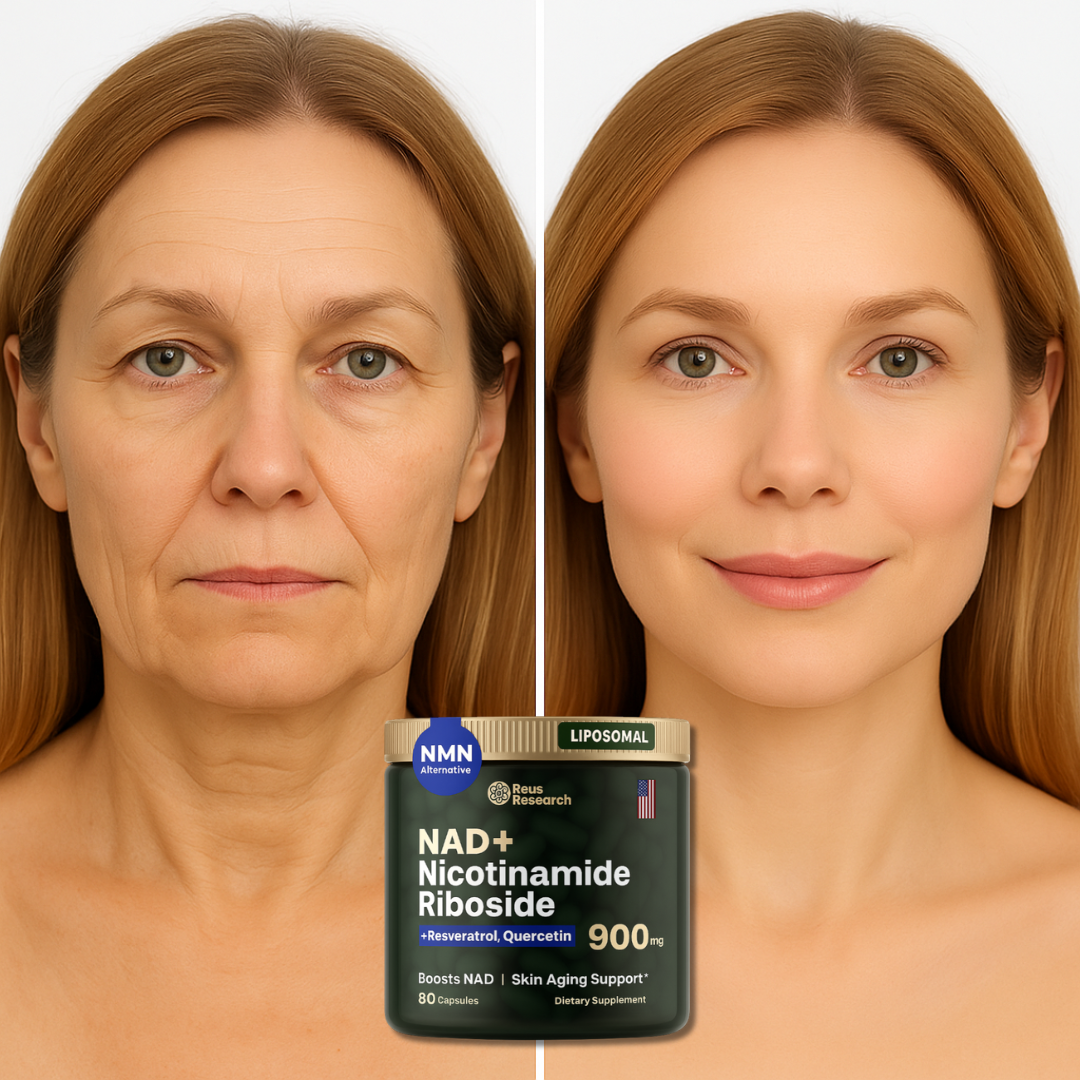 NAD+  Nicotinamide Riboside Skin Aging Suppport | 80 Caps